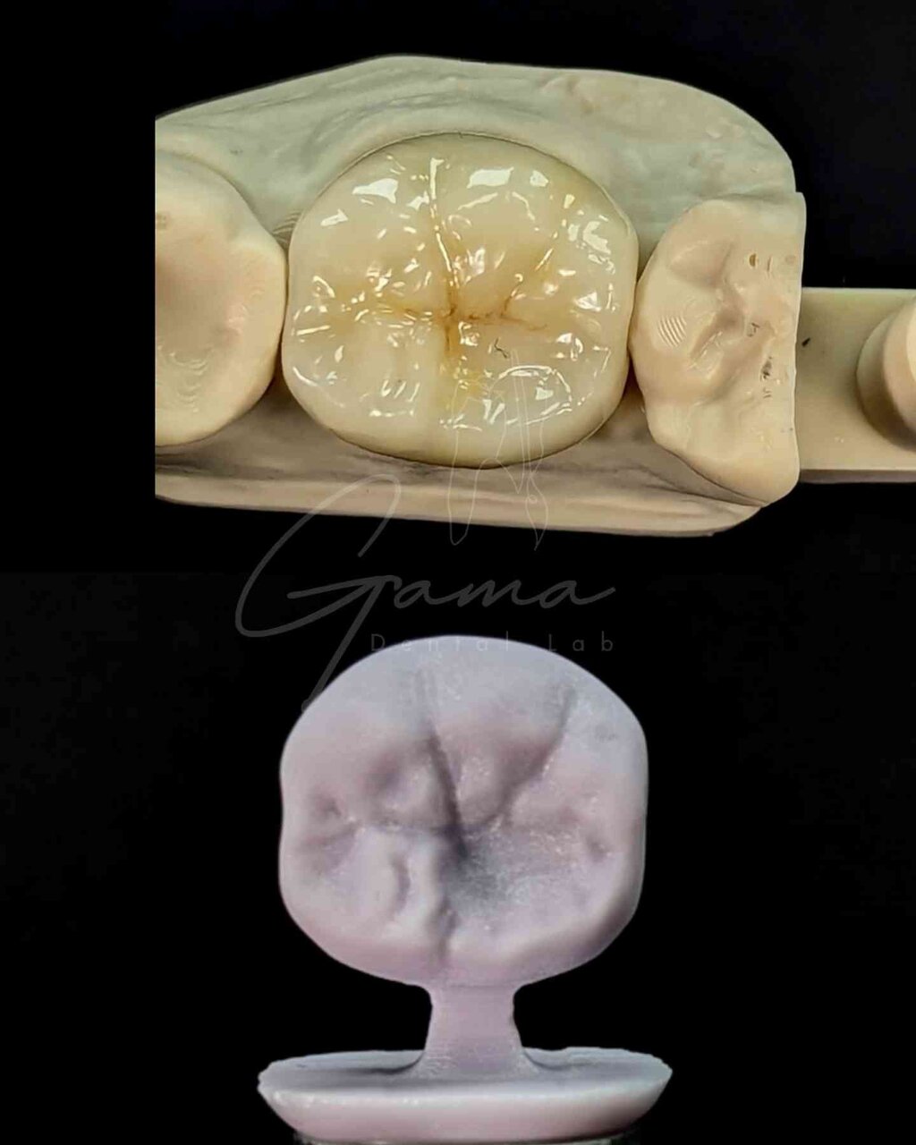 Corona EMAX - Gama Dental Lab